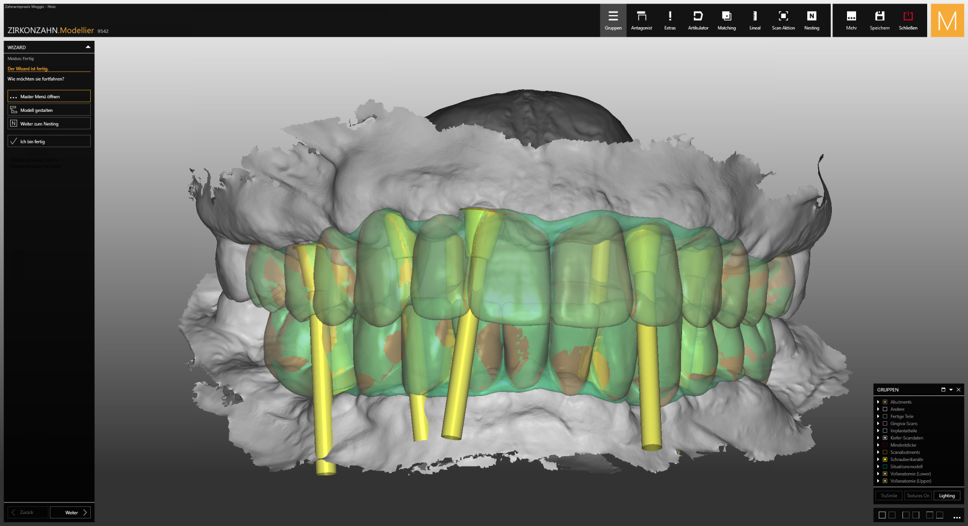 Implantate Implantate